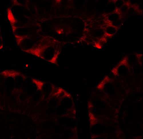 3 - CFTR Antibody ASC11771