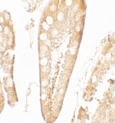 2 - CFTR Antibody ASC11771