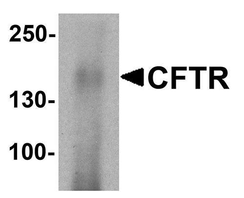 1 - CFTR Antibody ASC11771