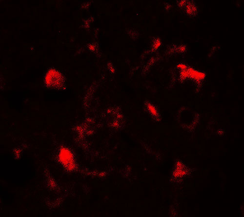 3 - TET1 Antibody ASC11779