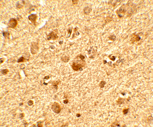 2 - TET1 Antibody ASC11779