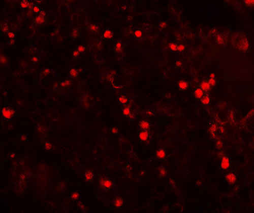 3 - TOPAZ1 Antibody ASC11780