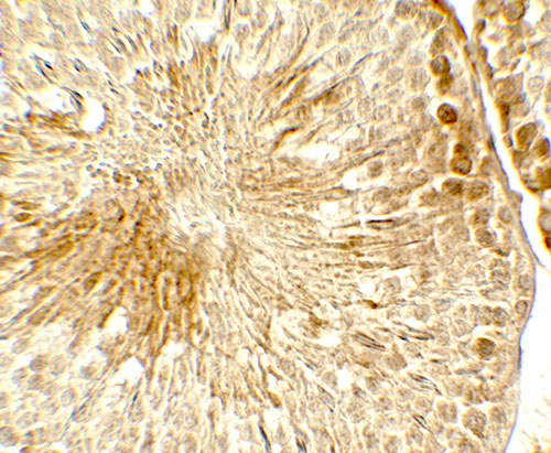 2 - TOPAZ1 Antibody ASC11780