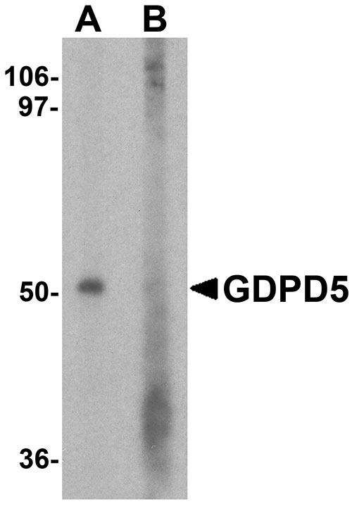 1 - GDPD5 Antibody ASC11781