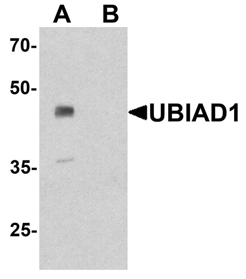 1 - UBIAD1 Antibody ASC11785