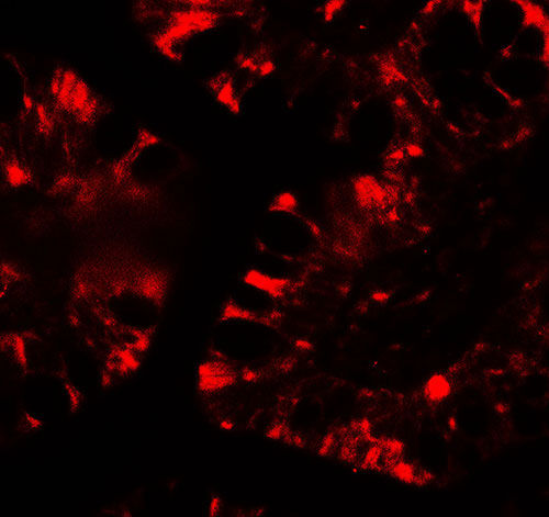 3 - IFIT1 Antibody ASC11787