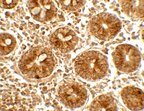 2 - IFIT1 Antibody ASC11787