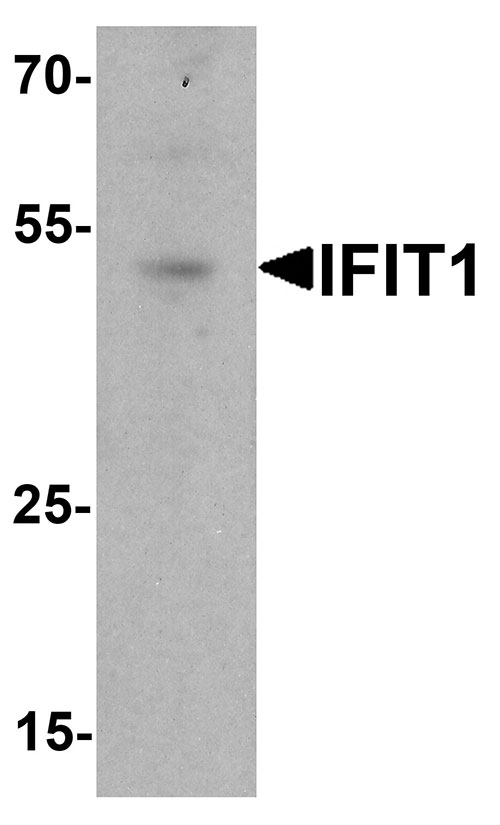 1 - IFIT1 Antibody ASC11787