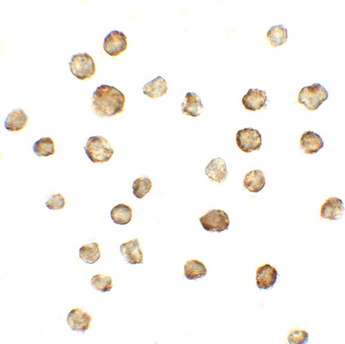 8 - ATMIN Antibody ASC11793