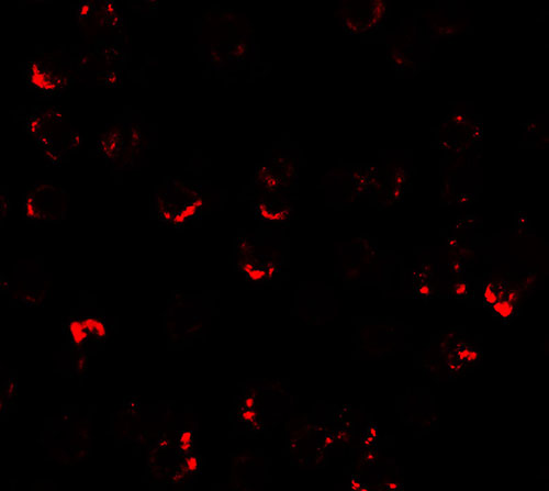 3 - ATMIN Antibody ASC11793