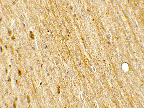 2 - POU2F3 Antibody ASC11800