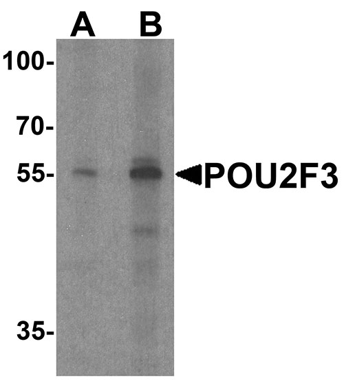 1 - POU2F3 Antibody ASC11800