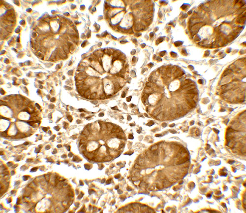 2 - TICRR Antibody ASC11813