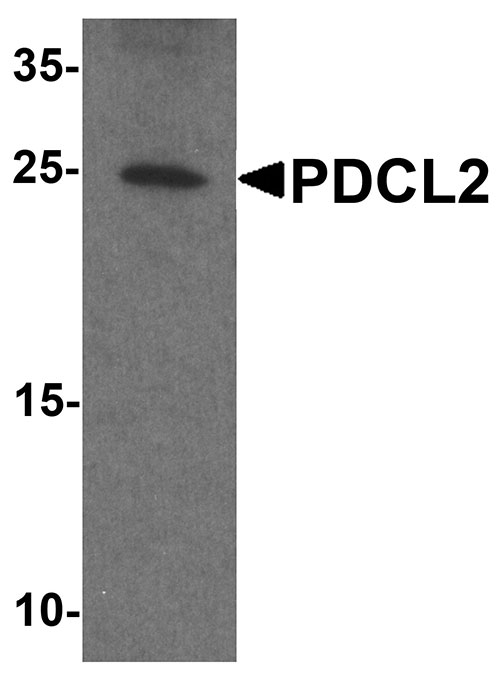 1 - PDCL2 Antibody ASC11820