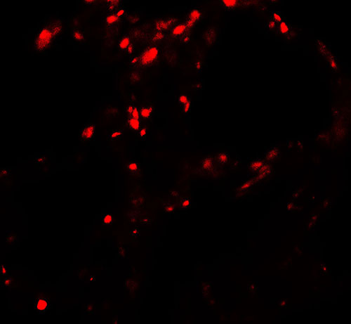 3 - BAMBI Antibody ASC11837