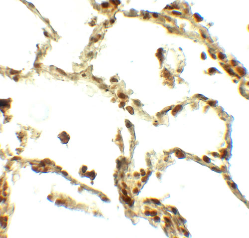 2 - BAMBI Antibody ASC11837