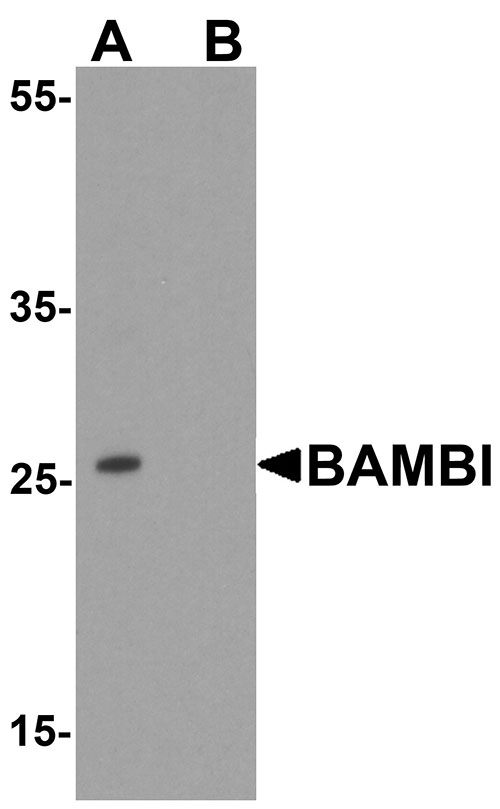 1 - BAMBI Antibody ASC11837