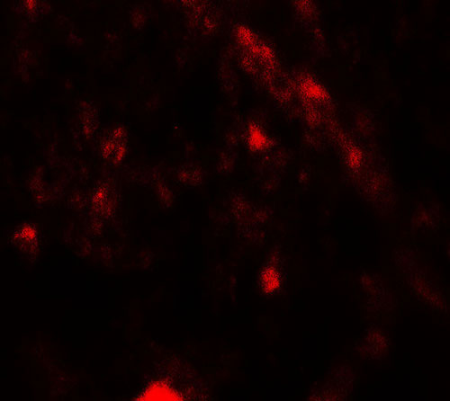 3 - PIK3R4 Antibody ASC11846