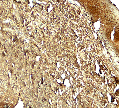 2 - PIK3R4 Antibody ASC11846