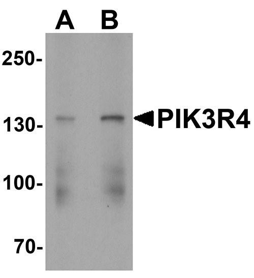 1 - PIK3R4 Antibody ASC11846