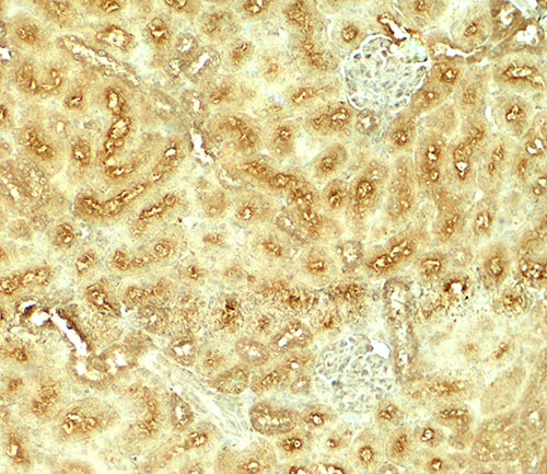 2 - VEZT Antibody ASC11849