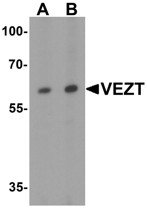 1 - VEZT Antibody ASC11849