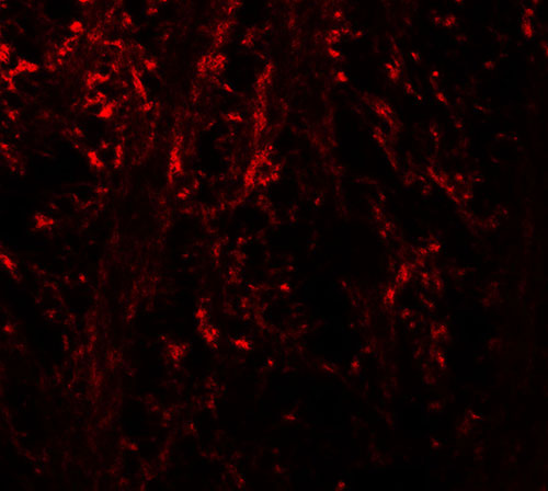3 - NINJ1 Antibody ASC11852