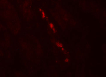3 - Nephrin Antibody ASC11857