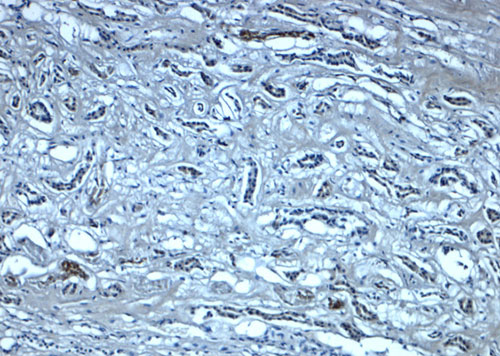 2 - Nephrin Antibody ASC11857