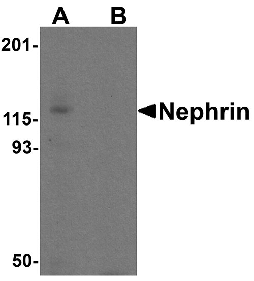 1 - Nephrin Antibody ASC11857