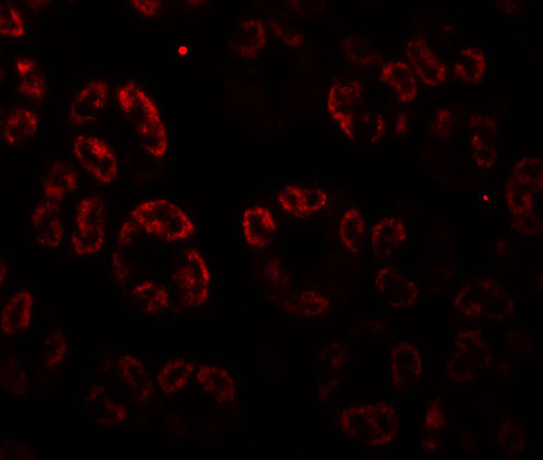 3 - SKI2W Antibody ASC11860