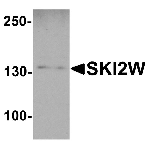 1 - SKI2W Antibody ASC11860