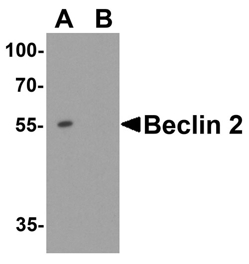 1 - WWC1 Antibody ASC11862