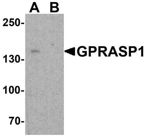 1 - GPRASP1 Antibody ASC11863