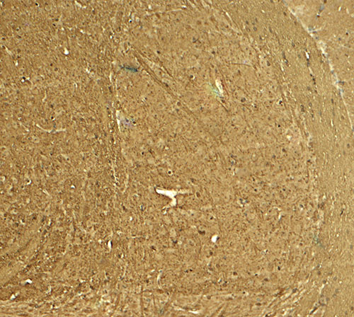 2 - PTPN5 Antibody ASC11866