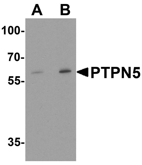 1 - PTPN5 Antibody ASC11866
