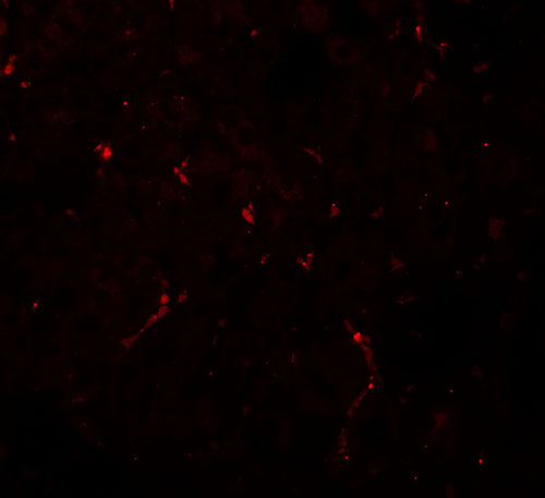 3 - NOSTRIN Antibody ASC11873