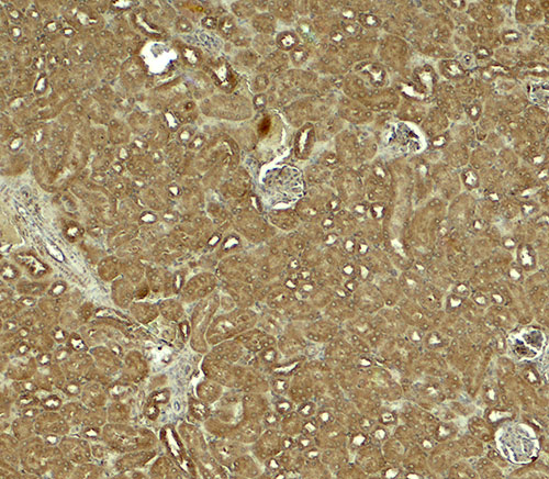 2 - NOSTRIN Antibody ASC11873