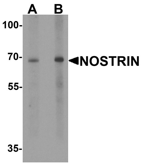1 - NOSTRIN Antibody ASC11873
