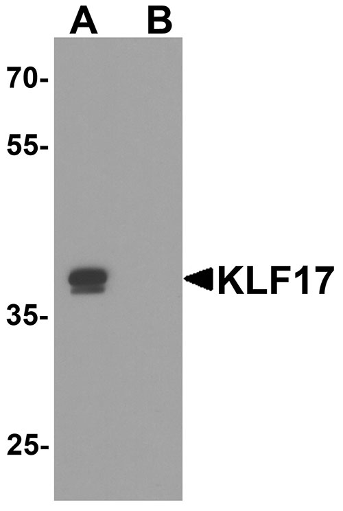 1 - KLF17 Antibody ASC11874