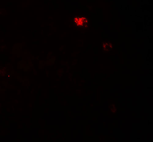 3 - PPM1D Antibody ASC11875