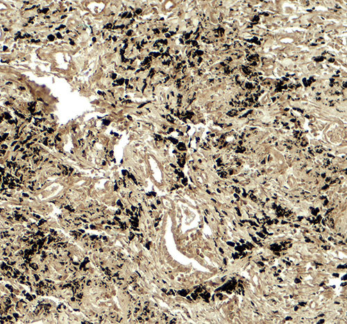 2 - PPM1D Antibody ASC11875