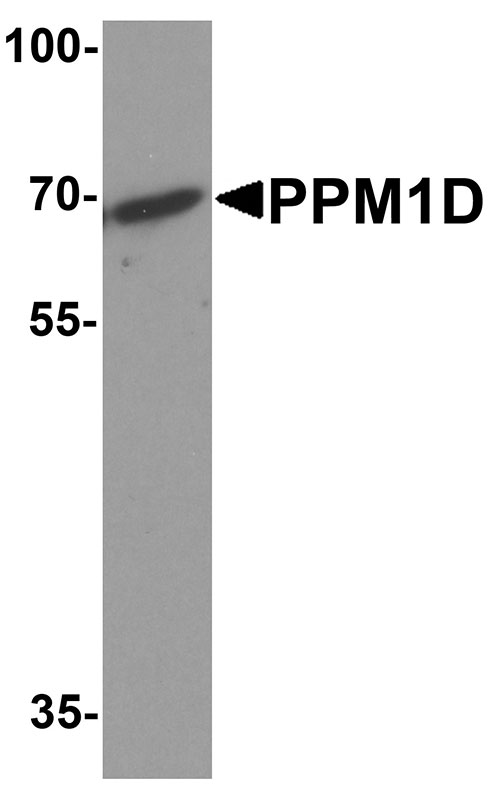 1 - PPM1D Antibody ASC11875