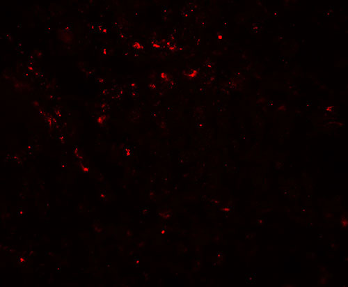 3 - LIMA1 Antibody ASC11877