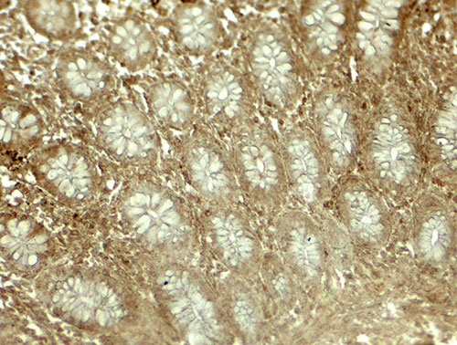 2 - LIMA1 Antibody ASC11877