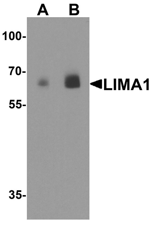 1 - LIMA1 Antibody ASC11877