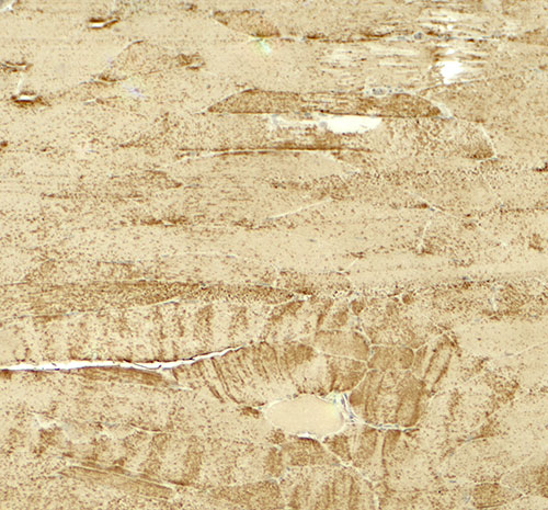 2 - MYH8 Antibody ASC11887