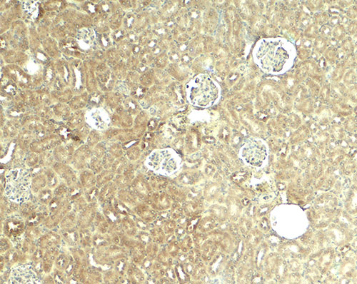 2 - GLIS2 Antibody ASC11892