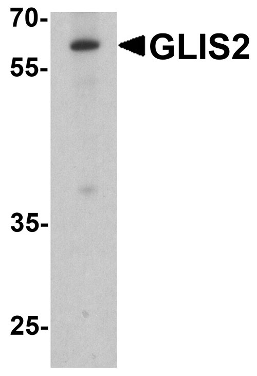 1 - GLIS2 Antibody ASC11892
