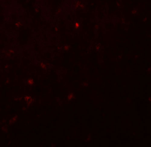 3 - IKZF2 Antibody ASC11900